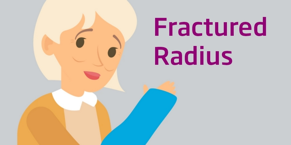 Mobilisation with movement after distal radius fracture