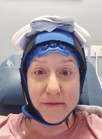 A cold cap allowed Emma to retain her hair during treatment.