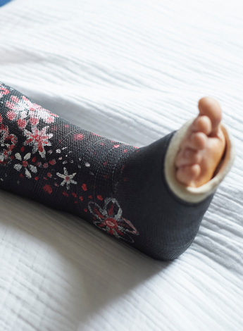 A foot lying on a bed covered in a cast