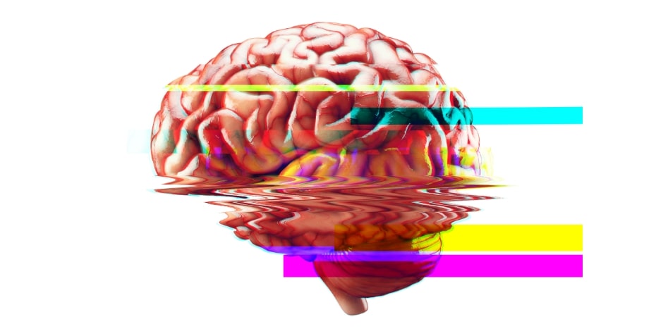 A human brain with colour bars distorting across it. 