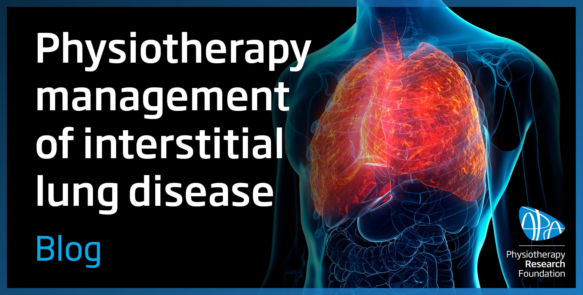 Physiotherapy management of interstitial lung disease