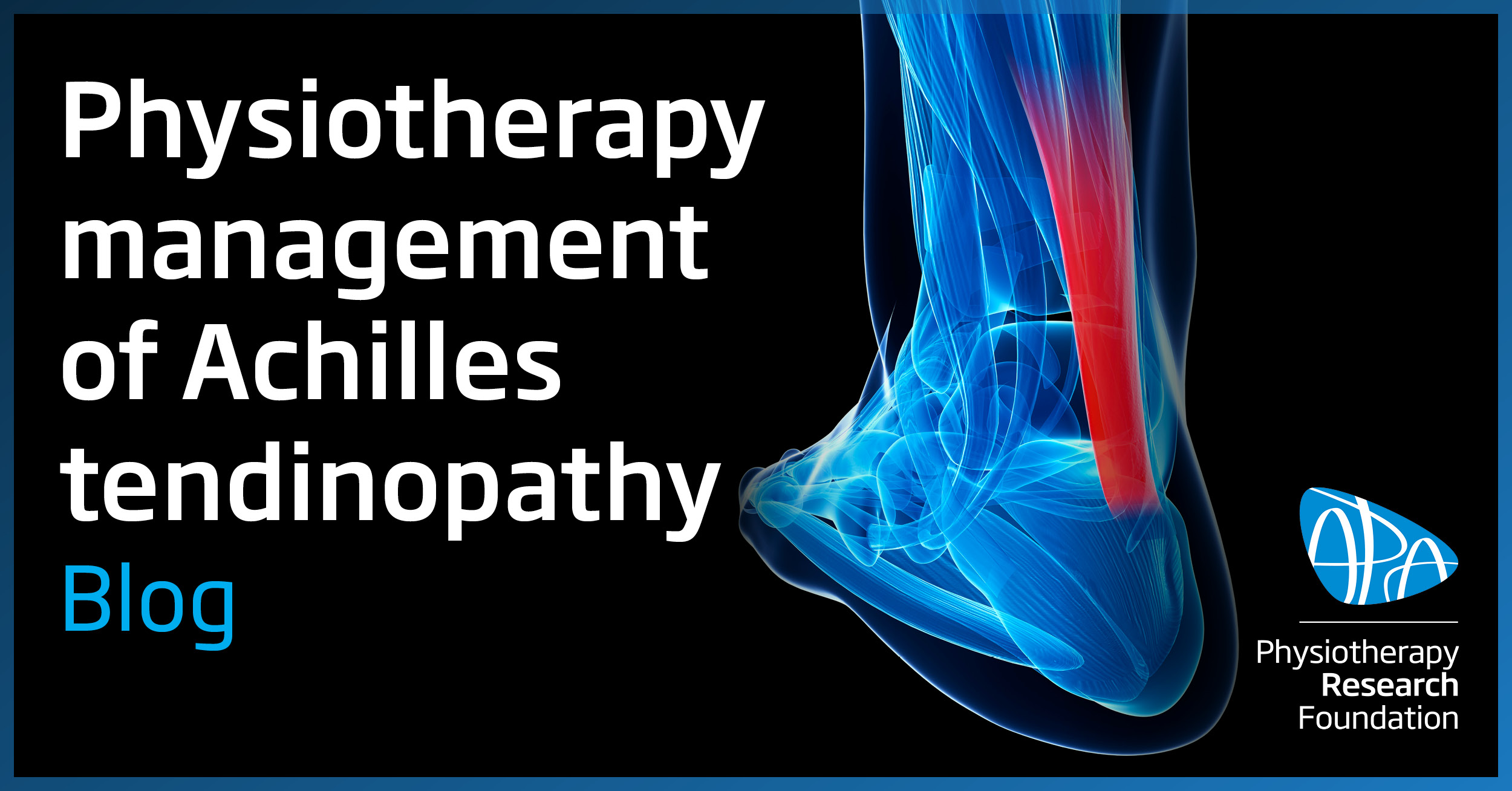 Physiotherapy management of Achilles tendinopathy