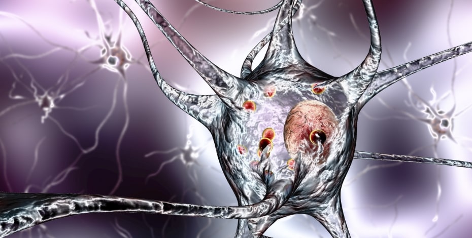 A graphic illustration of a neuron in the human brain.