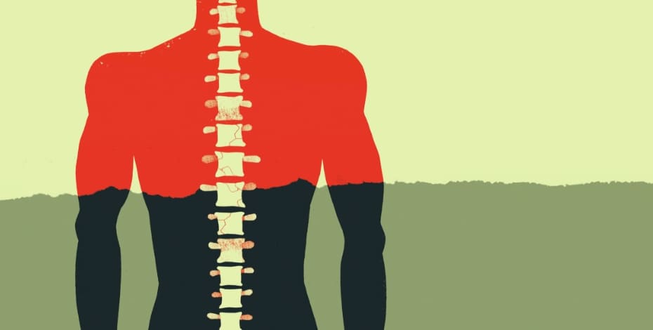 a graphic image of a torso showing the spinal column