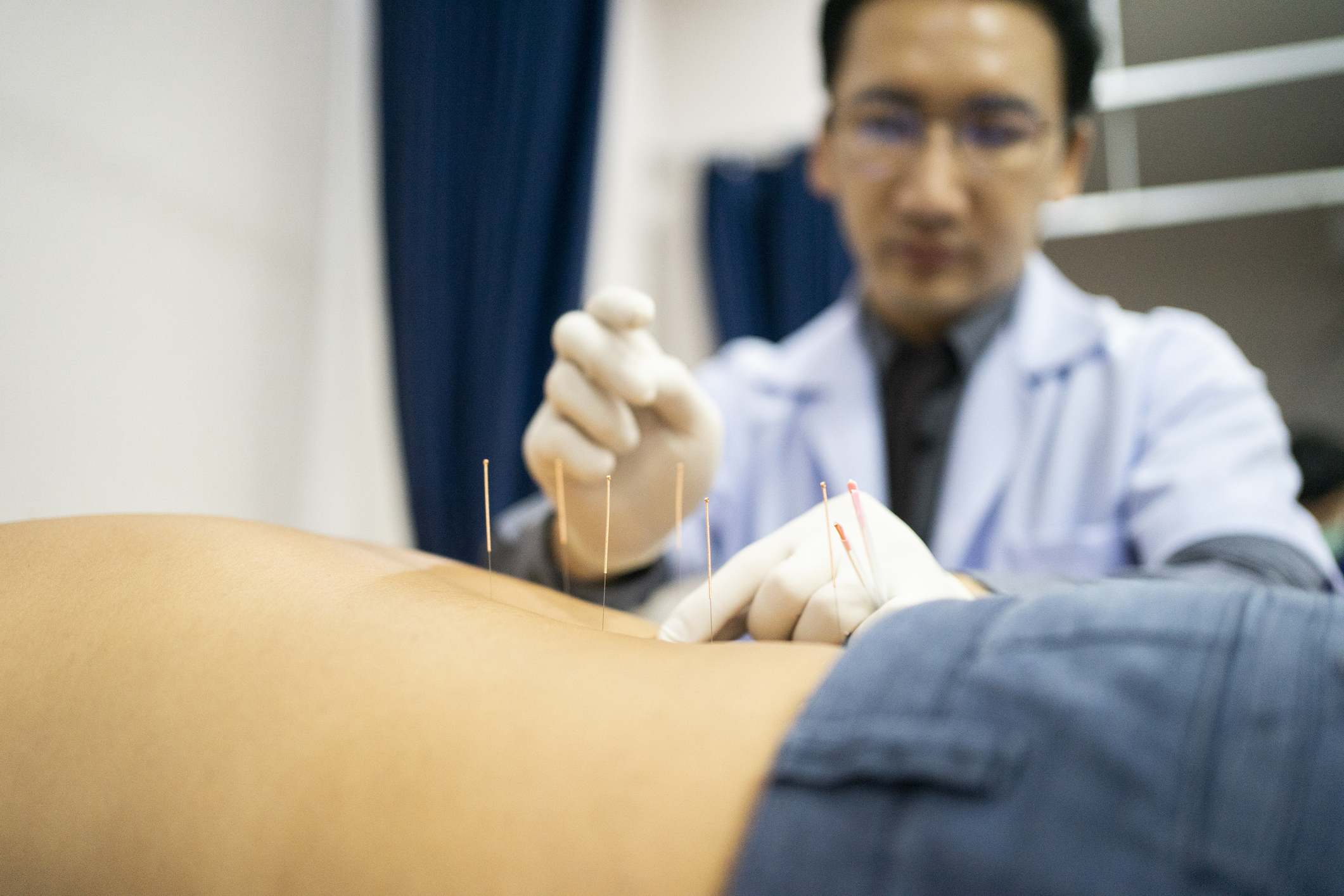 The image shows a patient getting acupuncture