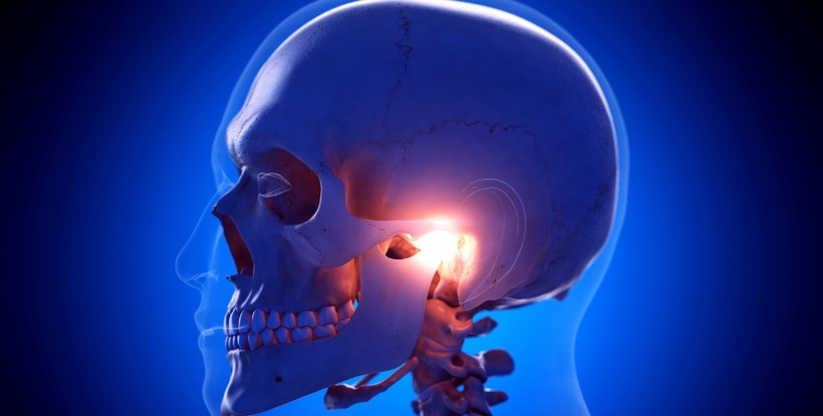 Graphic representing temperomandibular disorder