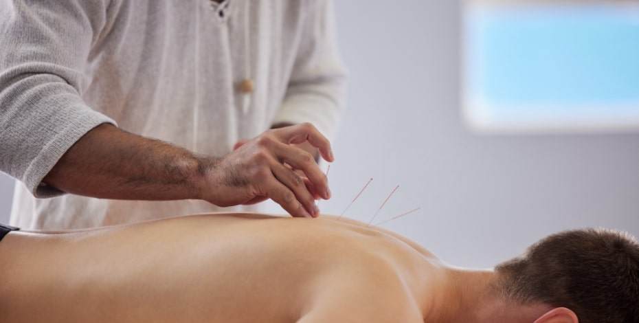Acupuncture for the whole person