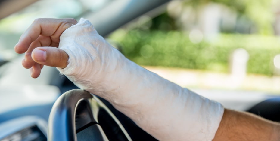 Upper limb injury and driving: when is it safe?