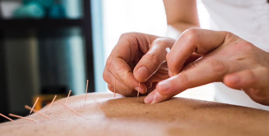 Why People Choose GEMt Dry Needling Training Courses