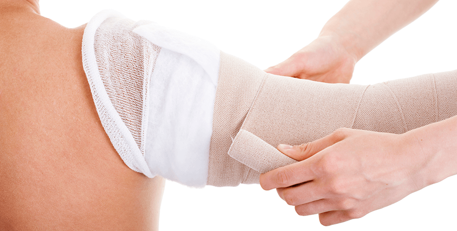 Physiotherapy treatment integral for Australians living with lymphoedema