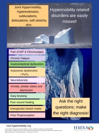 Joint Hypermobility Syndrome: Understanding, Diagnosis, and