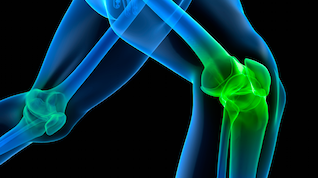 knee imaging